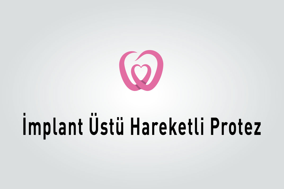 İmplant Üstü Hareketli Protez